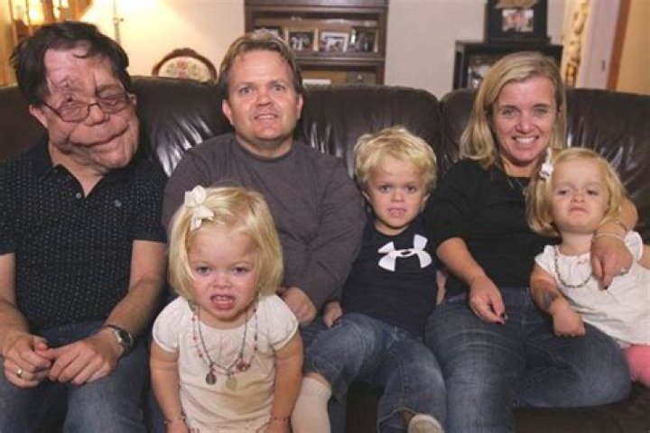Adam Pearson Wife: A Comprehensive Look into Their Relationship and Life Together