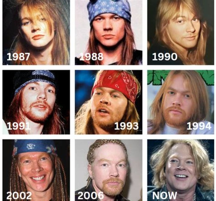 Axl Rose: The Evolution of a Rock Legend and What He Looks Like Now