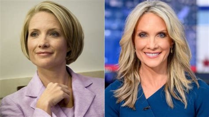 Dana Perino Before Plastic Surgery: The Untold Journey of Transformation