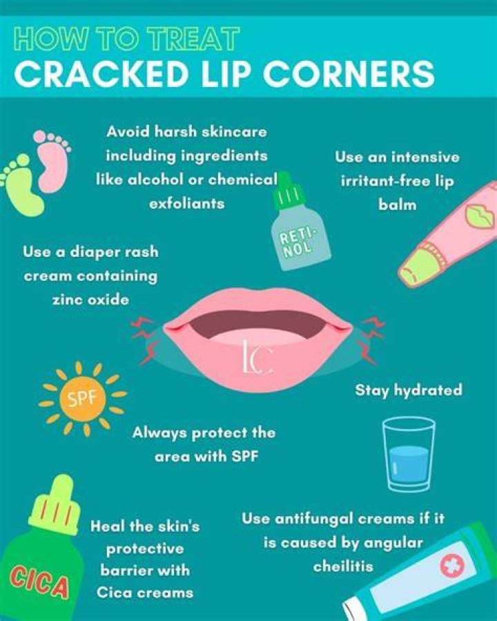 How to Prevent Not Chapped Lips SpongeBob: A Comprehensive Guide