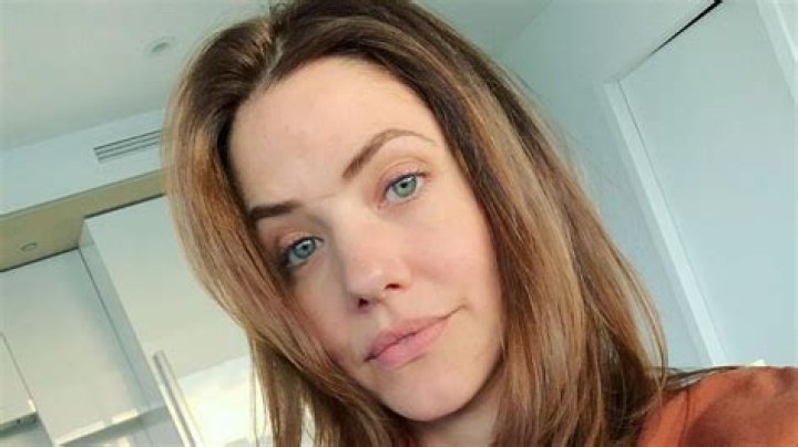 Julie Gonzalo's Scar: The Story & Significance You Didn't Know!
