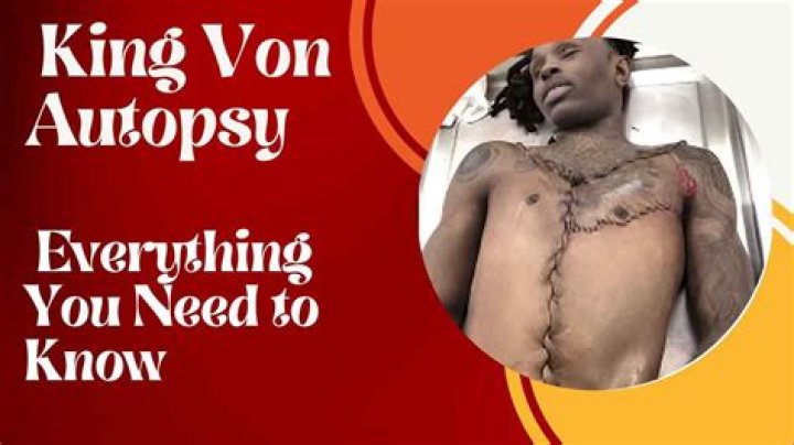 King Von Autopsy: A Comprehensive Analysis