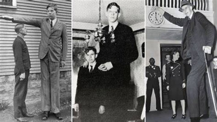 Robert Wadlow Condition: Understanding the Life and Legacy of the Tallest Man in History