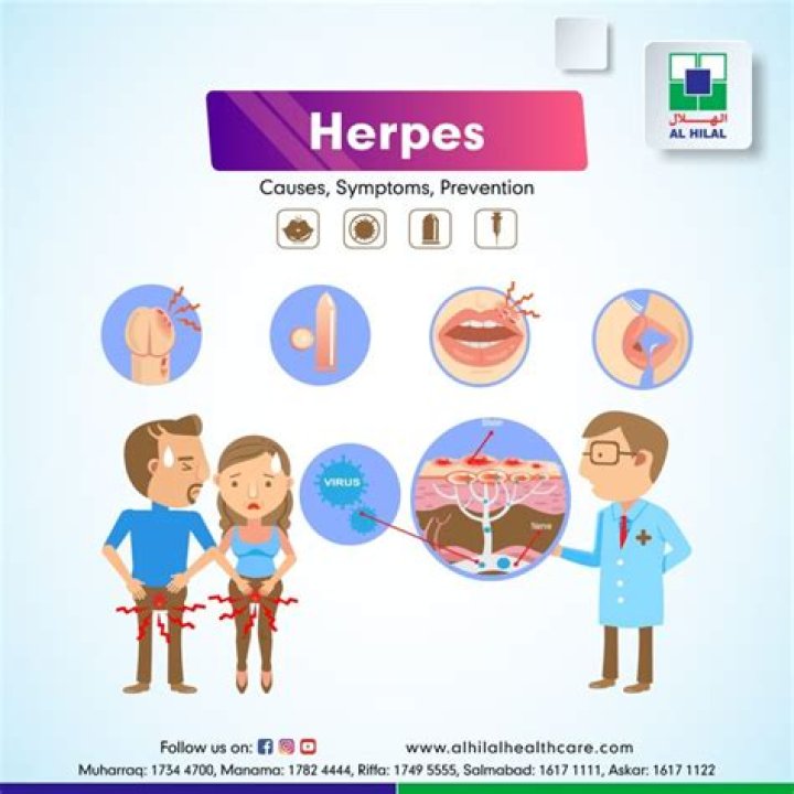 Should I Pop My Herpes? A Comprehensive Guide to Managing Herpes Symptoms