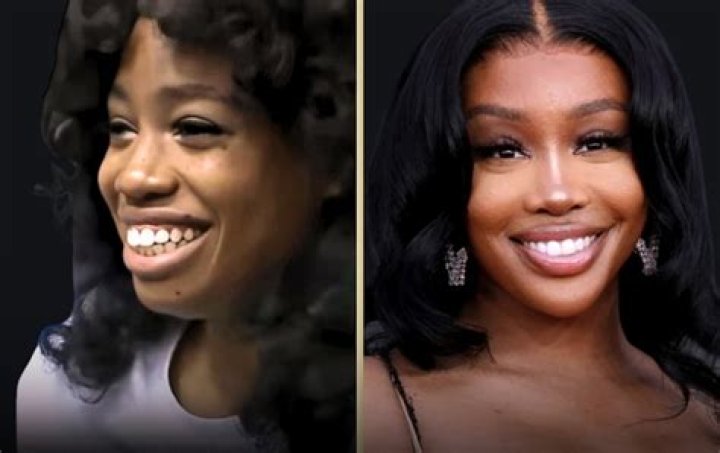 SZA's Plastic Surgery: Before & After & The Truth - What You Need to Know