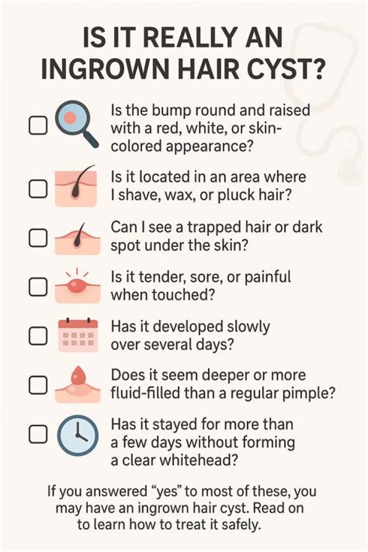 What to Put on Ingrown Hair Cyst: A Comprehensive Guide for Effective Treatment